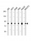 RPS6KA3 (S369) antibody